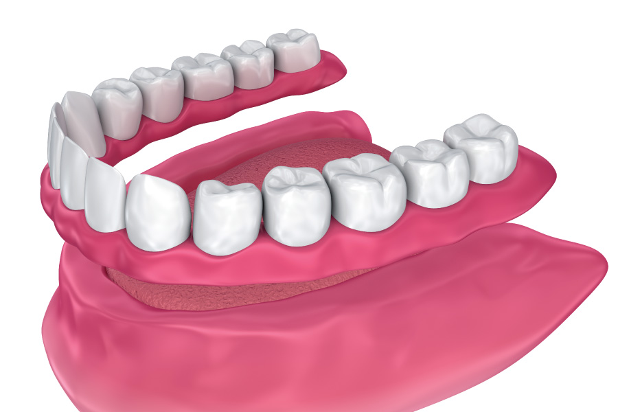 Renton IMmediate Dentures